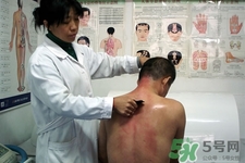 刮痧可以去濕氣嗎？體內(nèi)濕氣重刮痧有用嗎？