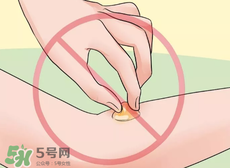 水泡怎么處理？水泡要不要刺破？
