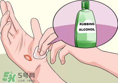 水泡怎么處理？水泡要不要刺破？