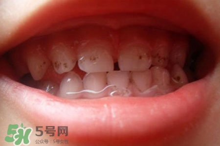 刷牙后吃東西發(fā)苦正常嗎？為什么刷牙后吃東西發(fā)苦？