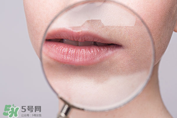 嘴唇起泡腫了怎么辦？嘴唇起泡腫了怎么消腫