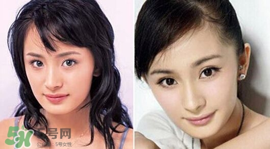 打瘦臉針能懷孕嗎？打瘦臉針能吃避孕藥嗎？