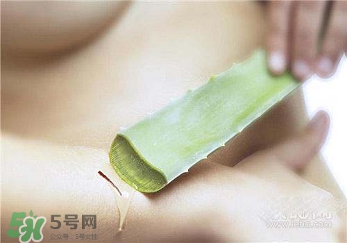 蘆薈涂在臉上發(fā)癢是怎么回事？蘆薈涂在臉上發(fā)癢怎么辦？