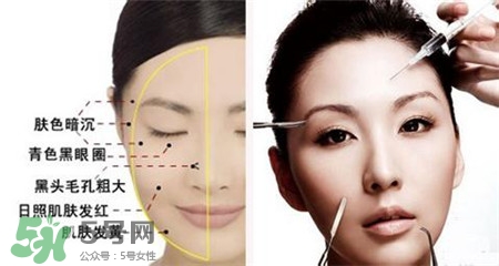 美白針的效果明顯嗎？美白針一個(gè)療程幾次？