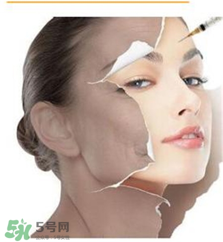 美白針安全嗎？美白針可以自己注射嗎？