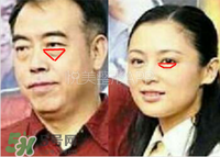 臥蠶是黑眼圈嗎？臥蠶和黑眼圈的區(qū)別