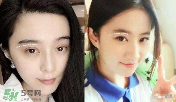 割雙眼皮有幾種做法？雙眼皮有哪幾種形狀？
