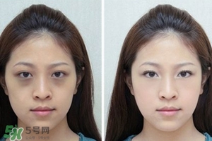 臥蠶是黑眼圈嗎？臥蠶和黑眼圈的區(qū)別