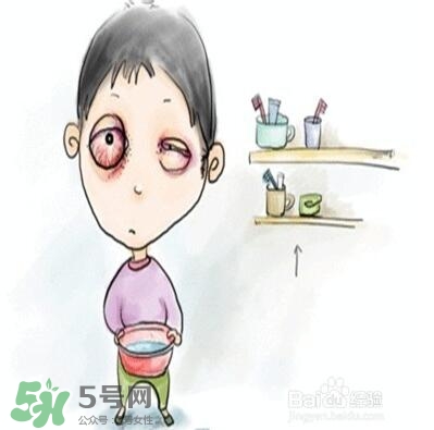 紅眼病是怎么引起的？紅眼病怎么產(chǎn)生的