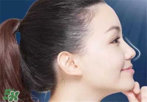 隆鼻會(huì)拉近眼距嗎？隆鼻會(huì)改變眼睛嗎？