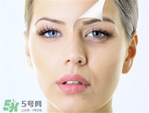 玻尿酸除皺有效果嗎？玻尿酸除皺效果怎么樣？