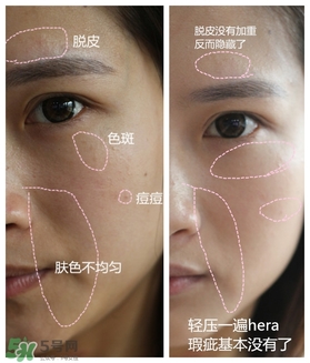 赫拉氣墊用了悶痘嗎？赫拉氣墊悶痘怎么辦？