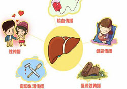 肝炎會傳染嗎？肝炎會不會傳染別人？