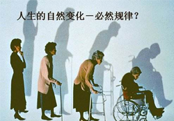 哪些人容易得骨質(zhì)疏松癥？骨質(zhì)疏松的高發(fā)人群有哪些？