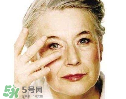 老年斑是怎么形成的？老年斑的形成原因