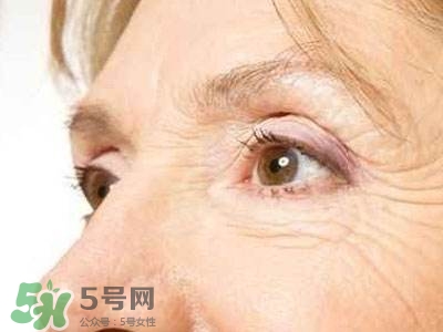 老年斑是怎么形成的？老年斑的形成原因