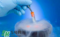凍卵是什么？?jī)雎炎有枰嗌馘X？