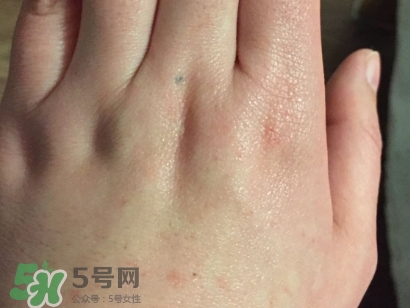 薇諾娜適合什么皮膚？薇諾娜適合敏感肌嗎？