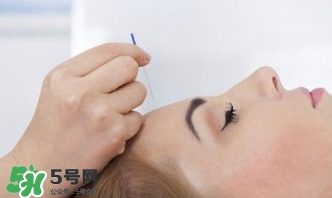 叢集性頭痛會(huì)死人嗎？叢集性頭痛的特點(diǎn)