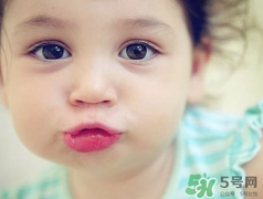孕期可以激光祛斑嗎？懷孕了能做激光祛斑嗎？