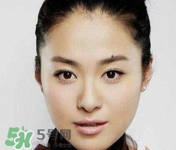 如何預(yù)防臉上長(zhǎng)痣？怎樣預(yù)防臉上長(zhǎng)痣