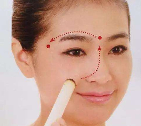 艾灸可以去黑眼圈嗎？艾灸可不可以去黑眼圈