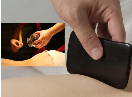 刮痧之后可以拔罐嗎？刮痧之后可不可以拔罐