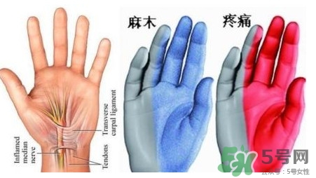 手腳發(fā)麻是缺鈣嗎？手腳發(fā)麻是不是缺鈣