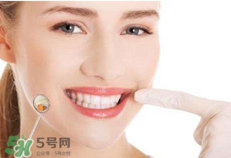 如何去掉牙結(jié)石？牙結(jié)石怎么去除