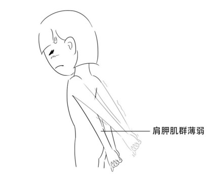 高低肩怎么糾正？高低肩的危害
