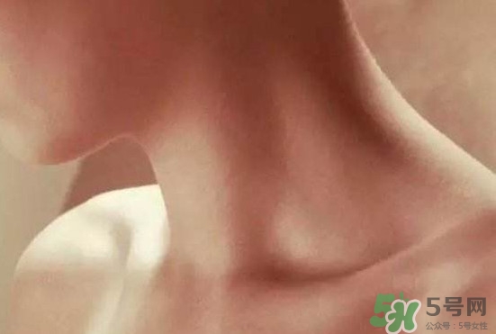 頸椎老化是什么?。款i椎老化的癥狀