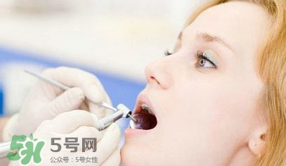 牙齒松動(dòng)能自己恢復(fù)嗎？牙齒松動(dòng)會(huì)自己恢復(fù)嗎