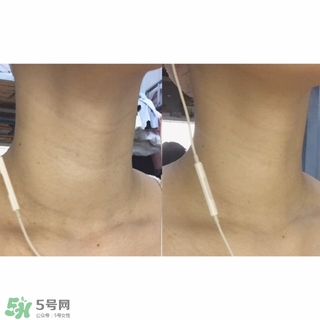 悅薇適合什么年齡？資生堂悅薇適合年齡段