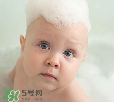 寶寶頭皮上的污垢可以摳掉嗎？寶寶頭上的頭垢該怎么處理？