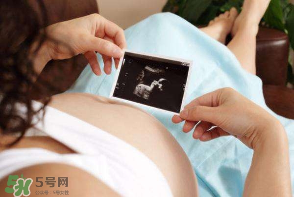 四維彩超能看出男女嗎？四維彩超能看清手指嗎？