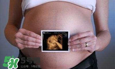 四維彩超能看出男女嗎？四維彩超能看清手指嗎？