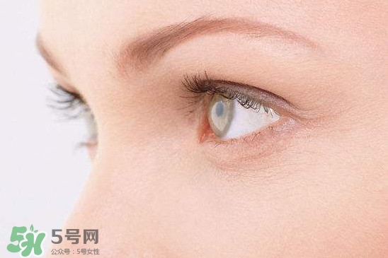 眼睛布滿血絲怎么回事？眼睛布滿血絲怎么辦