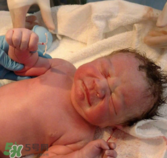 新生兒手握避孕環(huán)出生是怎么回事？出生后健康嗎？