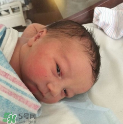 新生兒手握避孕環(huán)出生是怎么回事？出生后健康嗎？