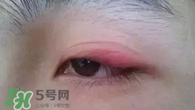 長期用假睫毛雙眼皮貼對眼睛有什么傷害？