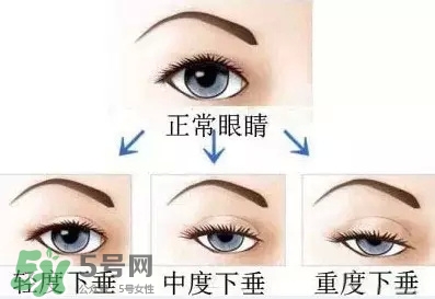 長期用假睫毛雙眼皮貼對眼睛有什么傷害？