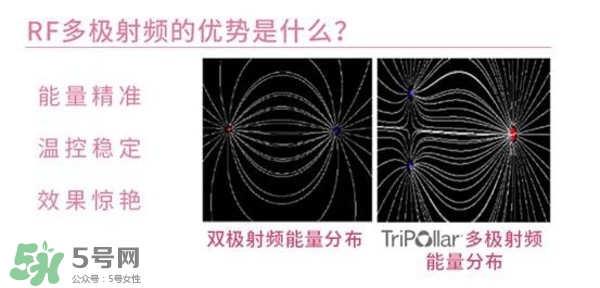 tripollar stop怎么樣？tripollar pose好用嗎