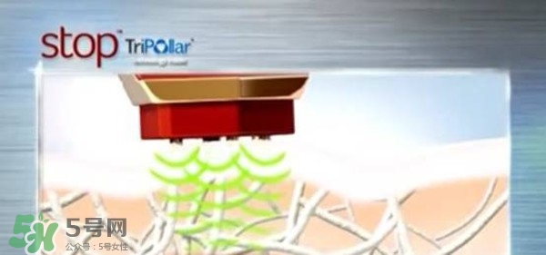 tripollar stop怎么樣？tripollar pose好用嗎