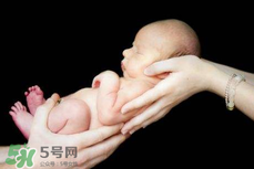 寶寶臍帶掉了要緊嗎？寶寶臍帶掉了出血了怎么辦？