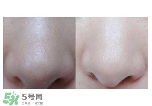 碧柔鼻貼白色和黑色哪個(gè)好？碧柔鼻貼黑白區(qū)別