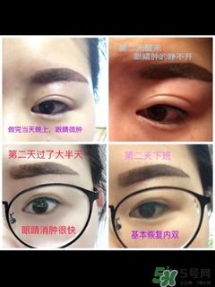 半永久霧眉圖片 半永久霧眉結(jié)痂時(shí)圖片