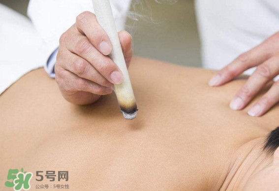 一天中什么時間艾灸好？艾灸什么時間做最好