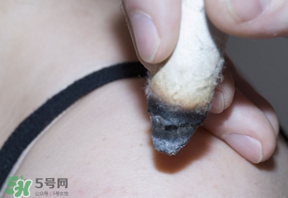 艾灸后為什么會(huì)癢？艾灸后為什么要多喝水