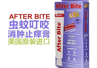 after bite止癢膏好用嗎？after bite止癢膏怎么樣？
