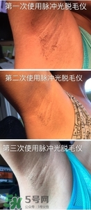 松下es wh93脫毛儀怎么樣？松下es wh93脫毛儀多少錢